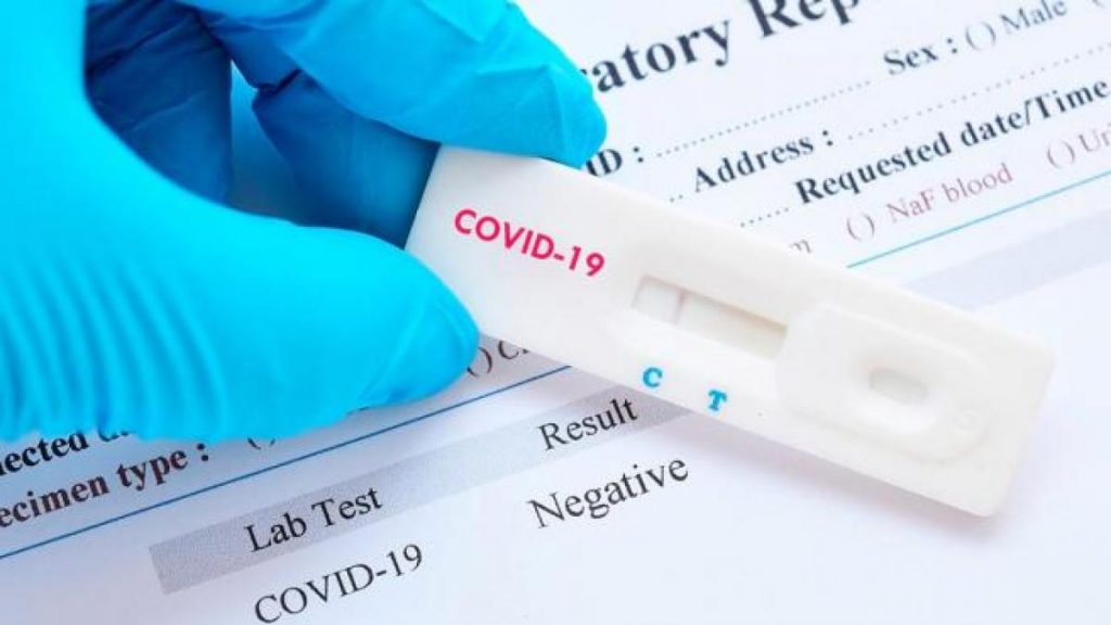 Notifican 39 nuevos contagios Covid y ninguna defunción