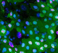 Descubren un tipo de muerte celular desconocido en los intestinos de la mosca