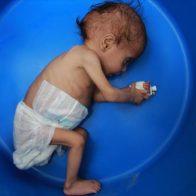 Unicef alerta de crisis de malnutrición infantil por precios de la comida