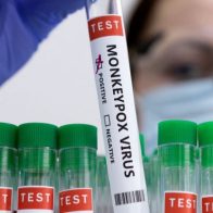 Identificado el primer caso de viruela del mono en Irlanda
