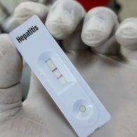 Argentina registra el primer caso de hepatitis aguda grave de origen desconocido