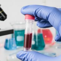 Argentina estudia 8 casos sospechosos de hepatitis aguda en niños