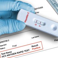 México reporta sus primeros casos de hepatitis aguda infantil
