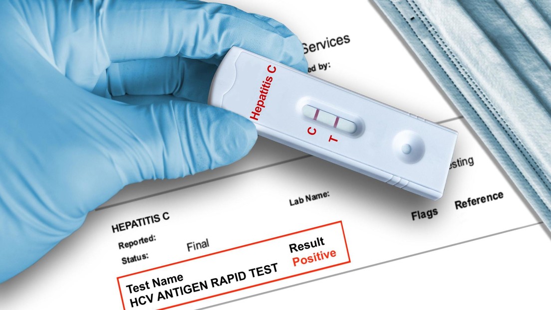 México reporta sus primeros casos de hepatitis aguda infantil