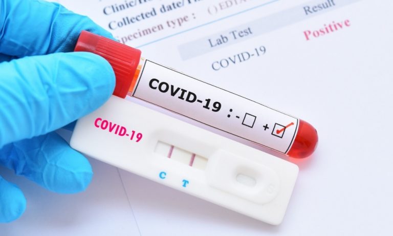 precios pruebas coronavirus mx gr | Noticias de hoy en De Último Minuto