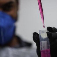 Portugal confirma 58 casos de viruela del mono; estudia vacunar a sanitarios