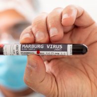 Detectan en Ghana primeros casos sospechosos de un virus altamente infeccioso similar al ébola