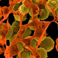 Infecciones y muertes por superbacterias resistentes a antibióticos aumentaron en EEUU