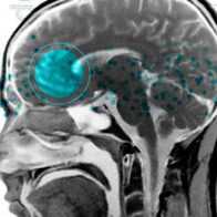 Científicos descubren la molécula que da origen al miedo en el cerebro