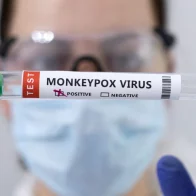 Brasil registra su segunda muerte por la viruela del mono