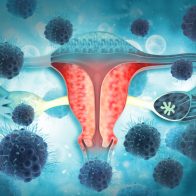 Nuevo test no invasivo avanza un año detección de cáncer de endometrio