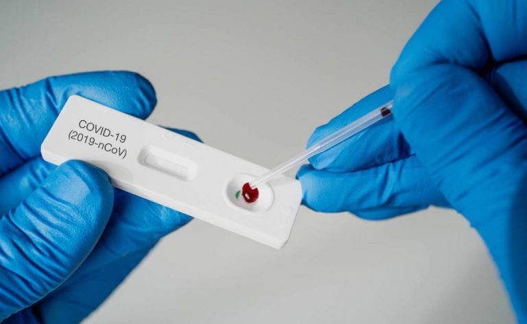 Autoridades de Salud reportan 153 nuevos contagios de covid-19 en RD 9 | Noticias de hoy en República Dominicana prueba del covid | Noticias de hoy en De Último Minuto