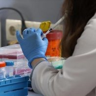 Indonesia confirma su primer caso de viruela del mono