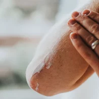 Epidermólisis