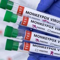 Argentina confirma su primer fallecido por viruela del mono