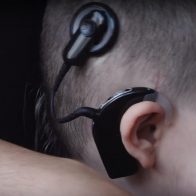 Pérdida de audición neurosensorial