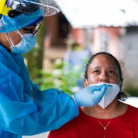 El 60 % de pacientes graves hospitalizados por covid en 2020 aún presentan secuelas