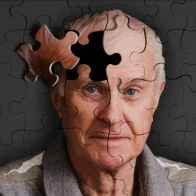 Alzheimer