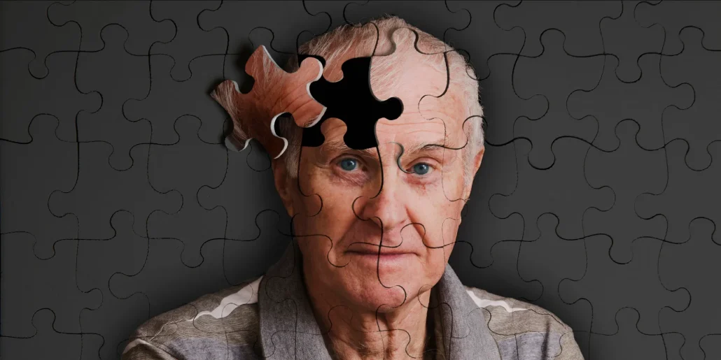 Alzheimer