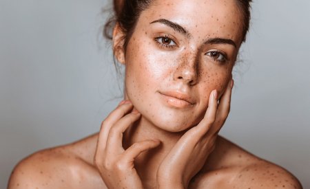 Día Internacional de las Manchas Cutáneas
