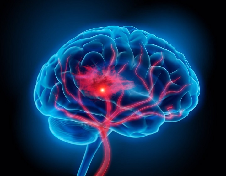 Día Mundial del Cerebro