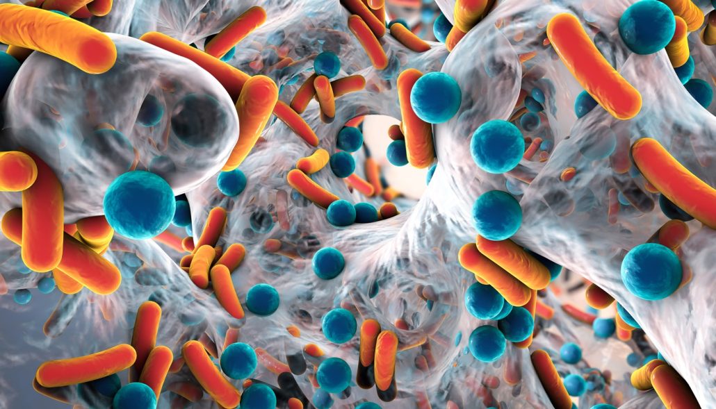 Bacteria "come carne" en Luisiana (EEUU) se disparan y dejan 6 muertos