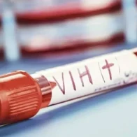 Honduras suma 42,085 casos de VIH desde 1985 tras diagnosticar 918 infecciones en 2023
