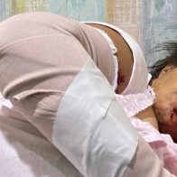 Una mujer en estado crítico tras ser atacada por dos perros pitbull en Santiago