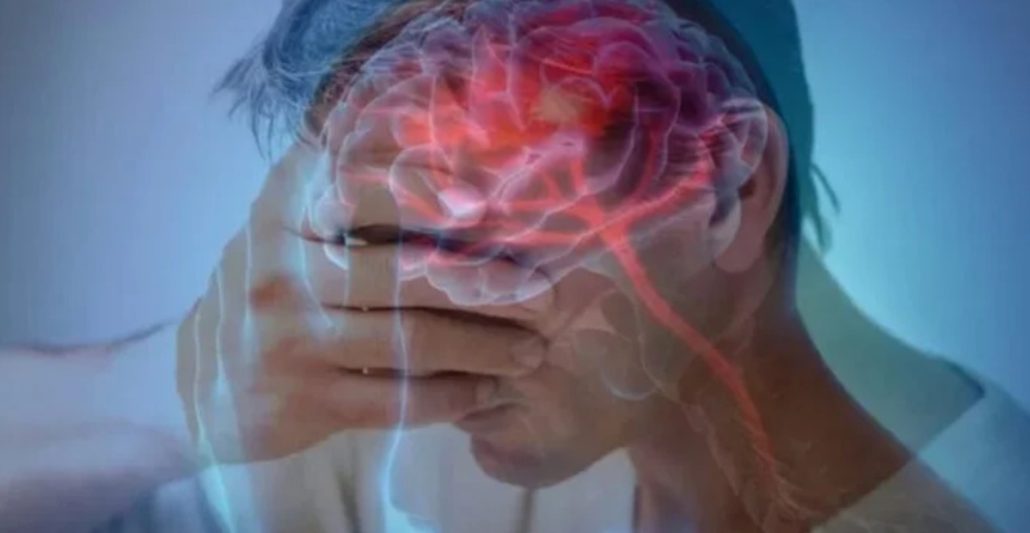 Dr. Luis Bonilla alerta sobre los riesgos detrás de los aneurismas cerebrales