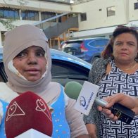 Mujer quemada con aceite caliente por su expareja exige justicia