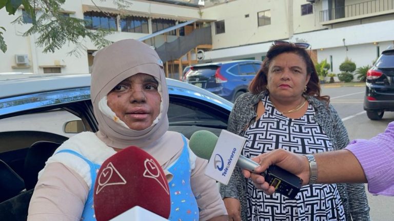 Mujer quemada con aceite caliente por su expareja exige justicia
