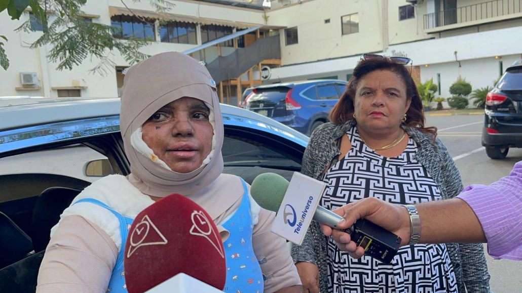 Mujer quemada con aceite caliente por su expareja exige justicia