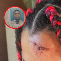 Apresan en Montecristi a sargento PN propinó golpiza a su pareja menor de edad