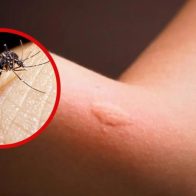 Reportan la primera muerte por dengue del 2024 en Puerto Rico