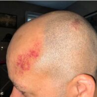 Fanáticos pro palestinos dan brutal paliza a pareja dominico - judía durante graduación en Brooklyn