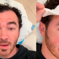 Kevin Jonas, de los Jonas Brothers, se somete a una intervención de cáncer de piel