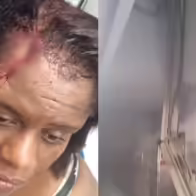Mujer resulta herida tras desprenderse viga de hierro en estación del metro
