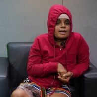 Mujer con quemaduras graves tras ataque con aceite caliente clama justicia