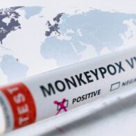 OMS advierte sobre transmisión de viruela del mono con casos notificados en 26 países