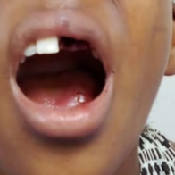 Niña pierde dientes tras ser golpeada presuntamente por su padre en San Cristóbal