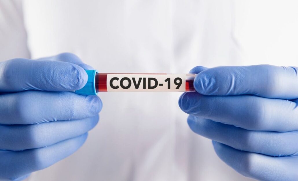 Detectan en Brasil la nueva variante de COVID conocida como “Frankenstein”