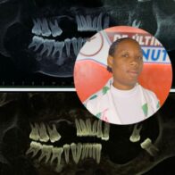 ¡Voz de auxilio! Joven busca ayuda económica para cirugía urgente