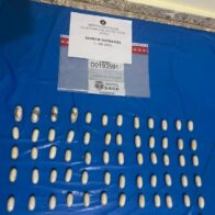 Detienen extranjero que viajaría a Francia con estomago lleno de bolsitas presumiblemente cocaína