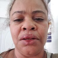 Conflicto entre vecinas de Los Alcarrizos termina en agresión física