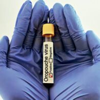 El Departamento de Salud (DS) de Puerto Rico emitió este jueves un aviso a los profesionales sanitarios a estar vigilantes al contagio del virus del oropouche