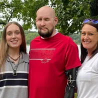 Aaron James, la primera persona en recibir un trasplante de ojo humano, muestra un progreso notable