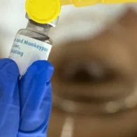 Llegan al Congo 100.000 dosis de la vacuna contra el mpox