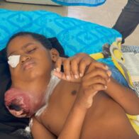 Familia en Santiago clama ayuda para salvar la vida de su hijo con tumor