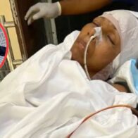 Joven solicita ayuda para cubrir gastos médicos de su madre con aneurismas cerebrales