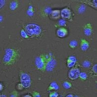 Prueban en ratones un compuesto químico que reduce la metástasis en cáncer de mama